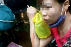 Truy tìm nhóm lạ mặt ném vỡ kính xe khách ở Thanh Hóa làm 1 phụ nữ bị thương